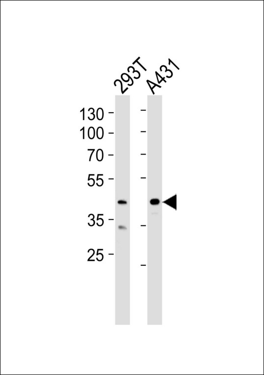 CSNK2A1 Antibody - Western blot of lysates from 293T, A431 cell line (from left to right) with CSNK2A1 Antibody. Antibody was diluted at 1:1000 at each lane. A goat anti-rabbit IgG H&L (HRP) at 1:5000 dilution was used as the secondary antibody. Lysates at 35 ug per lane.