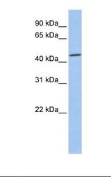CSNK2A1 Antibody - 721_B cell lysate. Antibody concentration: 1.0 ug/ml. Gel concentration: 12%.  This image was taken for the unconjugated form of this product. Other forms have not been tested.