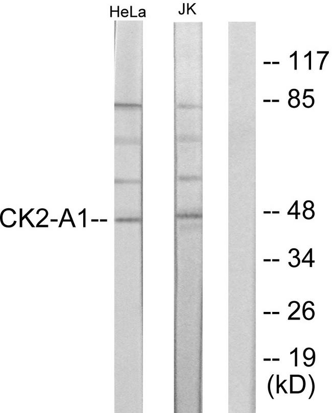 CSNK2A1 Antibody - Western blot analysis of lysates from HeLa and Jurkat cells, using Casein Kinase II alpha Antibody. The lane on the right is blocked with the synthesized peptide.