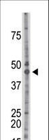 CSNK2A1 Antibody - The anti-CSNK2A1 antibody is used in Western blot to detect CSNK2A1 in mouse brain tissue lysate.