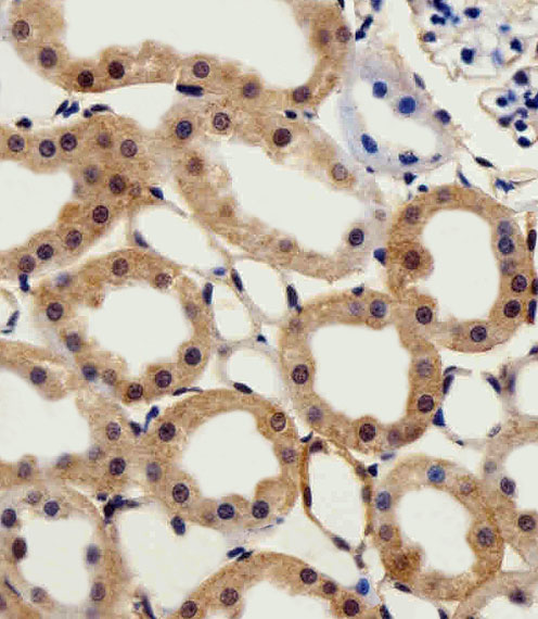 CSNK2A1 Antibody - Immunohistochemical of paraffin-embedded R.kidney section using CSNK2A1 Antibody. Antibody was diluted at 1:25 dilution. A peroxidase-conjugated goat anti-rabbit IgG at 1:400 dilution was used as the secondary antibody, followed by DAB staining.