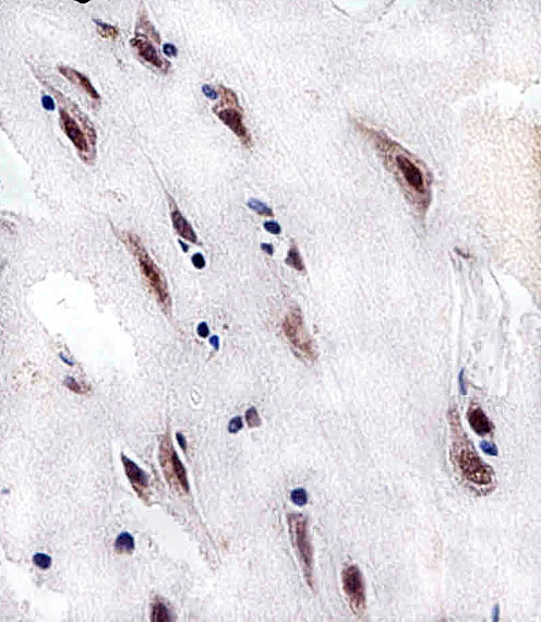 CSNK2A1 Antibody - Immunohistochemical of paraffin-embedded H. brain section using CSNK2A1 Antibody. Antibody was diluted at 1:25 dilution. A peroxidase-conjugated goat anti-rabbit IgG at 1:400 dilution was used as the secondary antibody, followed by DAB staining.