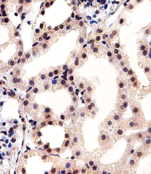 CSNK2A1 Antibody - Immunohistochemical of paraffin-embedded H.kidney section using CSNK2A1 Antibody. Antibody was diluted at 1:25 dilution. A peroxidase-conjugated goat anti-rabbit IgG at 1:400 dilution was used as the secondary antibody, followed by DAB staining.