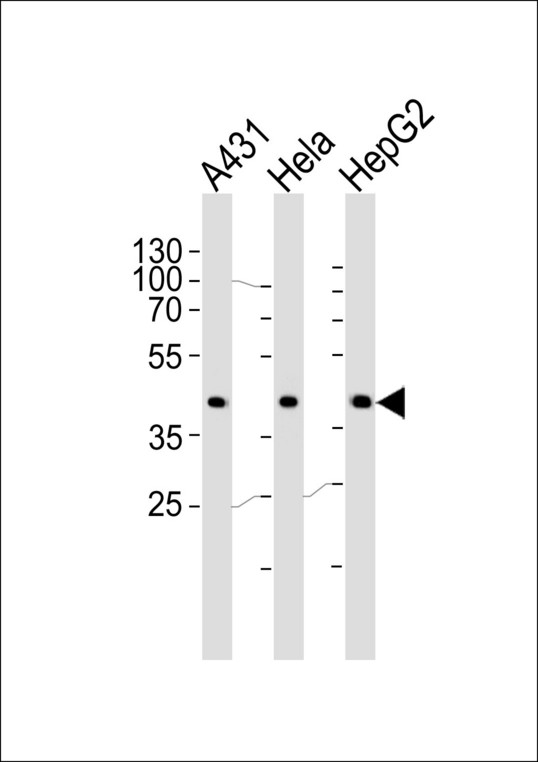 CSNK2A1 Antibody - Western blot of lysates from A431, HeLa, HepG2 cell line (from left to right) with CSNK2A1 Antibody. Antibody was diluted at 1:1000 at each lane. A goat anti-rabbit IgG H&L (HRP) at 1:5000 dilution was used as the secondary antibody. Lysates at 35 ug per lane.