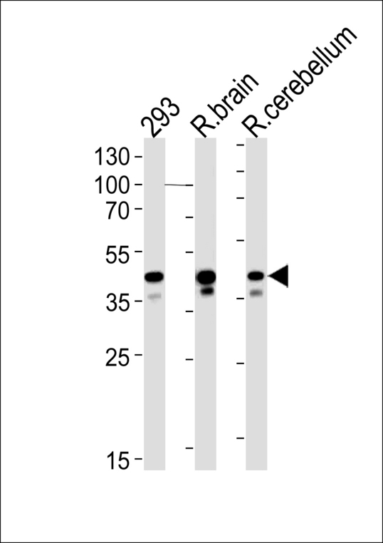 CSNK2A1 Antibody - Rat Csnk2a1 Antibody western blot of 293 cell line , rat brain and cerebellum tissue lysates (35 ug/lane). The Rat Csnk2a1 antibody detected the Rat Csnk2a1 protein (arrow).