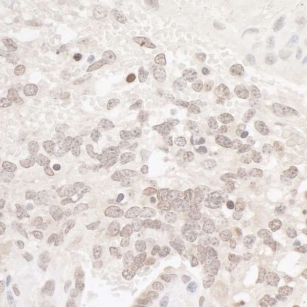 CSNK2A1 Antibody - Detection of mouse CKII Alpha by immunohistochemistry. Sample: FFPE section of mouse teratoma. Antibody: Affinity purified rabbit anti-CKII Alpha used at a dilution of 1:1,000 (1µg/ml). Detection: DAB