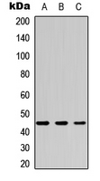CSNK2A1 Antibody - Western blot analysis of CK2 alpha expression in HEK293T (A); Raw264.7 (B); PC12 (C) whole cell lysates.