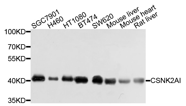 CSNK2A1 Antibody - Western blot analysis of extracts of various cell lines, using CSNK2A1 antibody at 1:1000 dilution. The secondary antibody used was an HRP Goat Anti-Rabbit IgG (H+L) at 1:10000 dilution. Lysates were loaded 25ug per lane and 3% nonfat dry milk in TBST was used for blocking. An ECL Kit was used for detection and the exposure time was 1s.