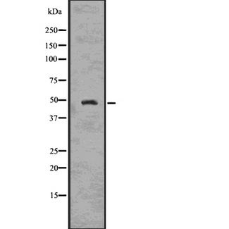 CSNK2A1 Antibody - Western blot analysis of CKII alpha using HepG2 whole cells lysates