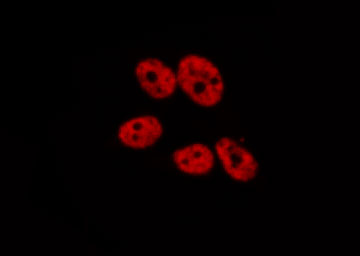 CSNK2A1 Antibody - Staining HeLa cells by IF/ICC. The samples were fixed with PFA and permeabilized in 0.1% Triton X-100, then blocked in 10% serum for 45 min at 25°C. The primary antibody was diluted at 1:200 and incubated with the sample for 1 hour at 37°C. An Alexa Fluor 594 conjugated goat anti-rabbit IgG (H+L) Ab, diluted at 1/600, was used as the secondary antibody.