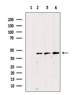 CSNK2A1 Antibody - Western blot analysis of extracts of various samples using CKII alpha antibody. Lane 1: mouse brain treated with blocking peptide. Lane 2: mouse brain; Lane 3: rat liver; Lane 4: 293;