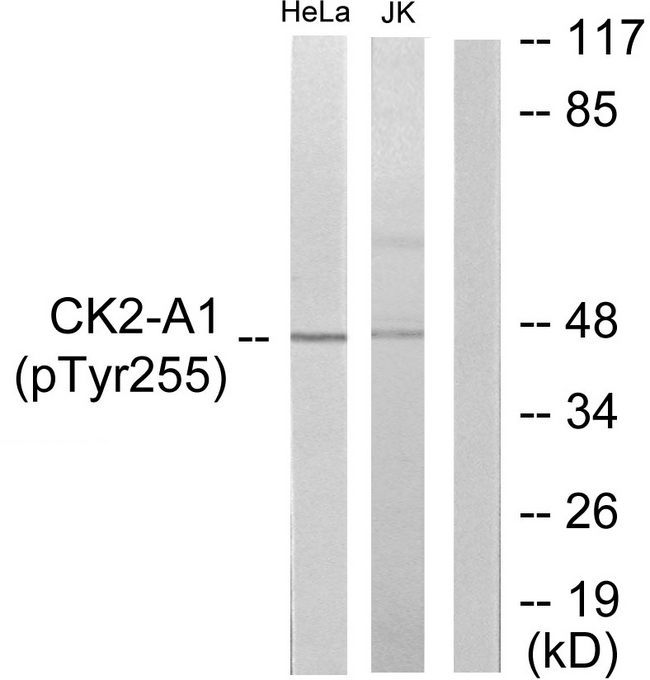 CSNK2A1 Antibody - Western blot analysis of lysates from HeLa cells and Jurkat cells, using Casein Kinase II alpha (Phospho-Tyr255) Antibody. The lane on the right is blocked with the phospho peptide.