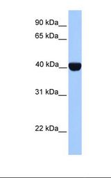 CSNK2A2 Antibody - MCF7 cell lysate. Antibody concentration: 1.0 ug/ml. Gel concentration: 12%.  This image was taken for the unconjugated form of this product. Other forms have not been tested.