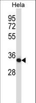 CSNK2A2 Antibody - Mouse Csnk2a2 Antibody western blot of HeLa cell line lysates (35 ug/lane). The Csnk2a2 antibody detected the Csnk2a2 protein (arrow).