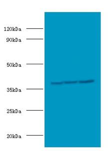 CSNK2A2 Antibody - Western blot of Casein kinase II subunit alpha' antibody at 2 ug/ml with HeLa whole cell lysate lane 1: HepG2 whole cell lysate lane 2: HeLa whole cell lysate lane 3: MCF-7 whole cell lysate. Secondary: Goat polyclonal to Rabbit IgG at 1:15000 dilution. Predicted band size: 50 KDa. Observed band size: 50 KDa.  This image was taken for the unconjugated form of this product. Other forms have not been tested.
