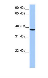 CSNK2A2 Antibody - HepG2 cell lysate. Antibody concentration: 1.0 ug/ml. Gel concentration: 12%.  This image was taken for the unconjugated form of this product. Other forms have not been tested.
