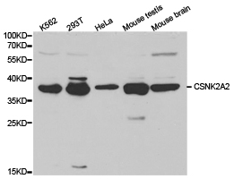 CSNK2A2 Antibody - Western blot of extracts of various cell lines, using CSNK2A2 antibody.