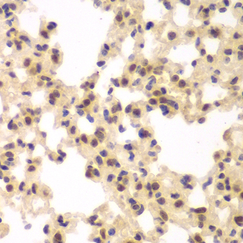 CSNK2A2 Antibody - Immunohistochemistry of paraffin-embedded rat lung tissue.