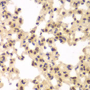 CSNK2A2 Antibody - Immunohistochemistry of paraffin-embedded rat lung tissue.