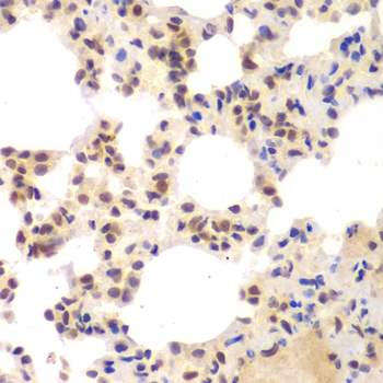 CSNK2A2 Antibody - Immunohistochemistry of paraffin-embedded mouse lung tissue.