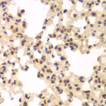 CSNK2A2 Antibody - Immunohistochemistry of paraffin-embedded rat lung using CSNK2A2 antibody at dilution of 1:100 (40x lens).