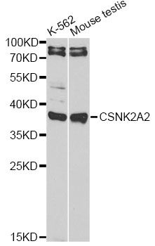 CSNK2A2 Antibody - Western blot analysis of extracts of various cell lines, using CSNK2A2 antibody at 1:1000 dilution. The secondary antibody used was an HRP Goat Anti-Rabbit IgG (H+L) at 1:10000 dilution. Lysates were loaded 25ug per lane and 3% nonfat dry milk in TBST was used for blocking.