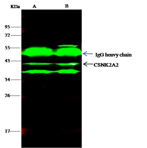 CSNK2A2 Antibody - CSNK2A2 was immunoprecipitated using: Lane A: 0.5 mg Jurkat Whole Cell Lysate. Lane B: 0.5 mg HepG2 Whole Cell Lysate. 4 uL anti-CSNK2A2 rabbit polyclonal antibody and 15 ul of 50% Protein G agarose. Primary antibody: Anti-CSNK2A2 rabbit polyclonal antibody, at 1:100 dilution. Secondary antibody: Dylight 800-labeled antibody to rabbit IgG (H+L), at 1:5000 dilution. Developed using the odssey technique. Performed under reducing conditions. Predicted band size: 41 kDa. Observed band size: 41 kDa.