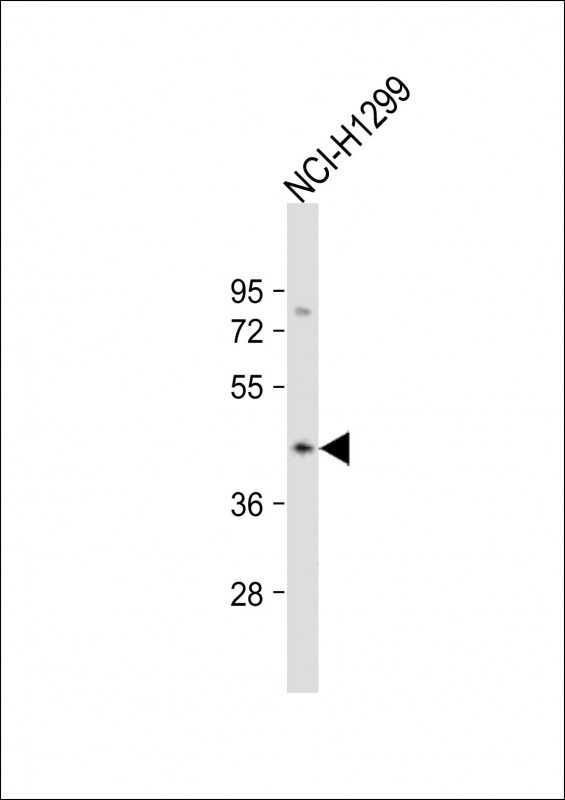 CSNK2A3 / CSNK2A1P Antibody - Anti-CSNK2A3 Antibody (N-Term) at 1:2000 dilution + NCI-H1299 whole cell lysate Lysates/proteins at 20 ug per lane. Secondary Goat Anti-Rabbit IgG, (H+L), Peroxidase conjugated at 1:10000 dilution. Predicted band size: 45 kDa. Blocking/Dilution buffer: 5% NFDM/TBST.