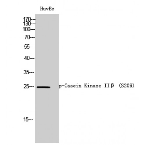 CSNK2B / Phosvitin Antibody - Western blot of Phospho-Casein Kinase IIbeta (S209) antibody