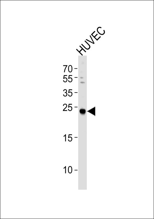 CSNK2B / Phosvitin Antibody - Western blot of lysate from HUVEC cell line, using CSNK2B Antibody. Antibody was diluted at 1:1000 at each lane. A goat anti-rabbit IgG H&L (HRP) at 1:5000 dilution was used as the secondary antibody. Lysate at 35ug per lane.