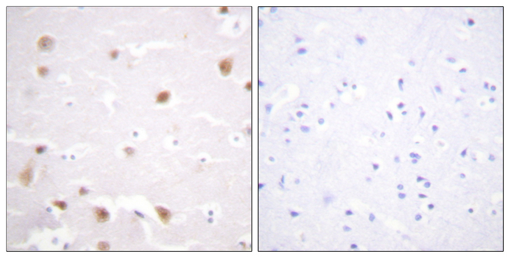 CSNK2B / Phosvitin Antibody - Immunohistochemistry analysis of paraffin-embedded human brain tissue, using CKII-beta Antibody. The picture on the right is blocked with the synthesized peptide.