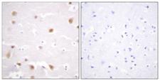 CSNK2B / Phosvitin Antibody - Immunohistochemistry analysis of paraffin-embedded human brain tissue, using CKII-beta Antibody. The picture on the right is blocked with the synthesized peptide.