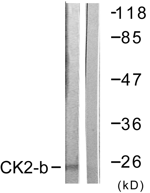CSNK2B / Phosvitin Antibody - Western blot analysis of lysates from HUVEC cells, using CKII-beta Antibody. The lane on the right is blocked with the synthesized peptide.
