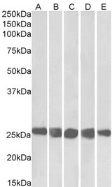 CSNK2B / Phosvitin Antibody - Antibody (0.3µg/ml) staining of NIH3T3 (A), HeLa (B), K562 (C), MCF7 (D) and HepG2 (E) lysates (35µg protein in RIPA buffer). Primary incubation was 1 hour. Detected by chemiluminescence.
