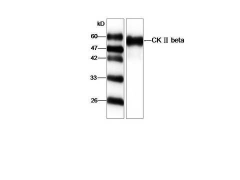CSNK2B / Phosvitin Antibody