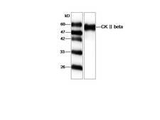 CSNK2B / Phosvitin Antibody