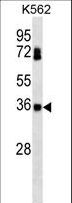 CSNK2B / Phosvitin Antibody - CSNK2B Antibody western blot of K562 cell line lysates (35 ug/lane). The CSNK2B antibody detected the CSNK2B protein (arrow).