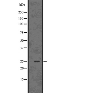 CSNK2B / Phosvitin Antibody - Western blot analysis of Casein Kinase 2 beta using HeLa whole cells lysates
