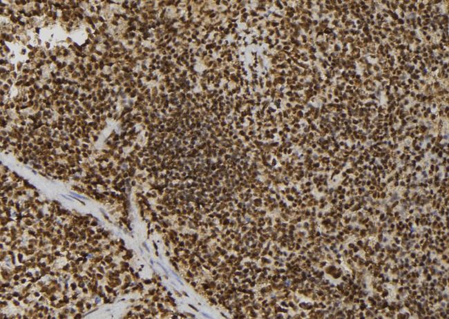 CSNK2B / Phosvitin Antibody - 1:100 staining mouse spleen tissue by IHC-P. The sample was formaldehyde fixed and a heat mediated antigen retrieval step in citrate buffer was performed. The sample was then blocked and incubated with the antibody for 1.5 hours at 22°C. An HRP conjugated goat anti-rabbit antibody was used as the secondary.