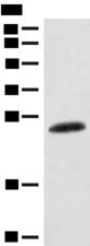 CSNK2B / Phosvitin Antibody - Western blot analysis of Mouse skin tissue lysate  using CSNK2B Polyclonal Antibody at dilution of 1:400