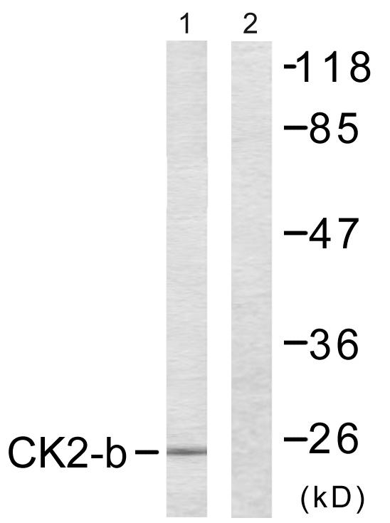 CSNK2B / Phosvitin Antibody - Western blot analysis of extracts from HuvEc cells, using CK2-ß (Ab-209) antibody.