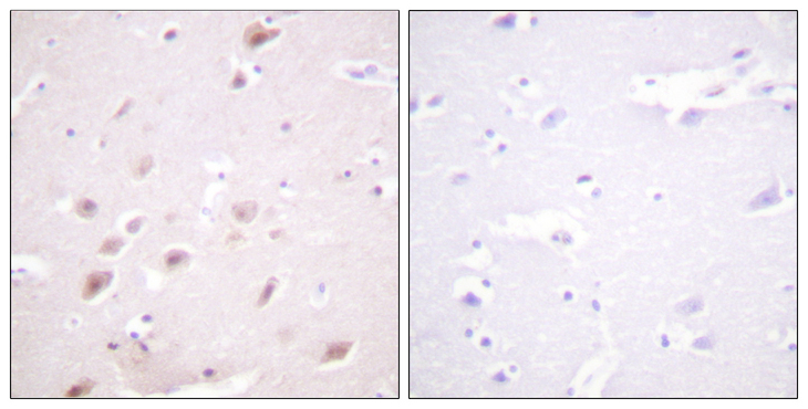 CSNK2B / Phosvitin Antibody - Immunohistochemistry analysis of paraffin-embedded human brain, using CKII-beta (Phospho-Ser209) Antibody. The picture on the right is blocked with the phospho peptide.