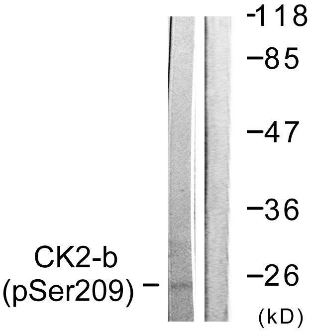 CSNK2B / Phosvitin Antibody - Western blot analysis of lysates from HUVEC cells, using CKII-beta (Phospho-Ser209) Antibody. The lane on the right is blocked with the phospho peptide.