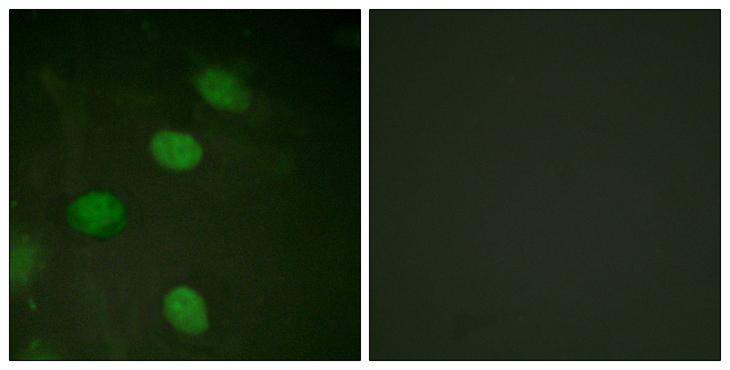 CSNK2B / Phosvitin Antibody - P-peptide - + Immunofluorescence analysis of HeLa cells, using c-Jun (Phospho-Thr231) antibody.