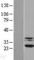 CSNK2B / Phosvitin Protein - Western validation with an anti-DDK antibody * L: Control HEK293 lysate R: Over-expression lysate