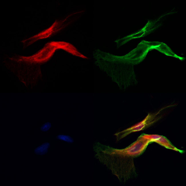 CSPG4 / NG2 Antibody - Staining HeLa cells by IF/ICC. The samples were fixed with PFA and permeabilized in 0.1% Triton X-100, then blocked in 10% serum for 45 min at 25°C. Samples were then incubated with primary Ab(1:200) and mouse anti-beta tubulin Ab(1:200) for 1 hour at 37°C. An AlexaFluor594 conjugated goat anti-rabbit IgG(H+L) Ab(1:200 Red) and an AlexaFluor488 conjugated goat anti-mouse IgG(H+L) Ab(1:600 Green) were used as the secondary antibod