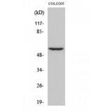 CSPG5 / Neuroglycan C Antibody - Western blot of Neuroglycan C antibody