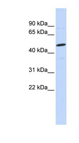 CSPG5 / Neuroglycan C Antibody - CSPG5 / Neuroglycan C antibody Western blot of MCF7 cell lysate. This image was taken for the unconjugated form of this product. Other forms have not been tested.