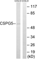 CSPG5 / Neuroglycan C Antibody - Western blot analysis of lysates from COLO and HeLa cells, using CSPG5 Antibody. The lane on the right is blocked with the synthesized peptide.