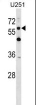 CSPG5 / Neuroglycan C Antibody - CSPG5 Antibody western blot of U251 cell line lysates (35 ug/lane). The CSPG5 antibody detected the CSPG5 protein (arrow).